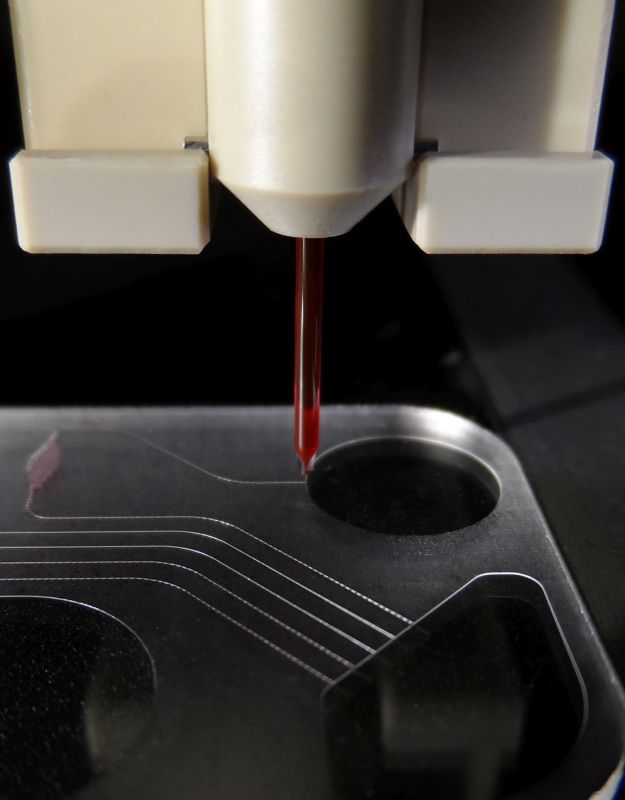 Microdispensing of droplets on a lab-on-a-chip device for point-of-care diagnostic applications